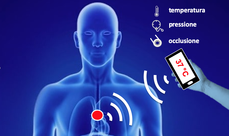 gallery Tecnologia Rfid: sensori nel corpo umano per un monitoraggio cyber
