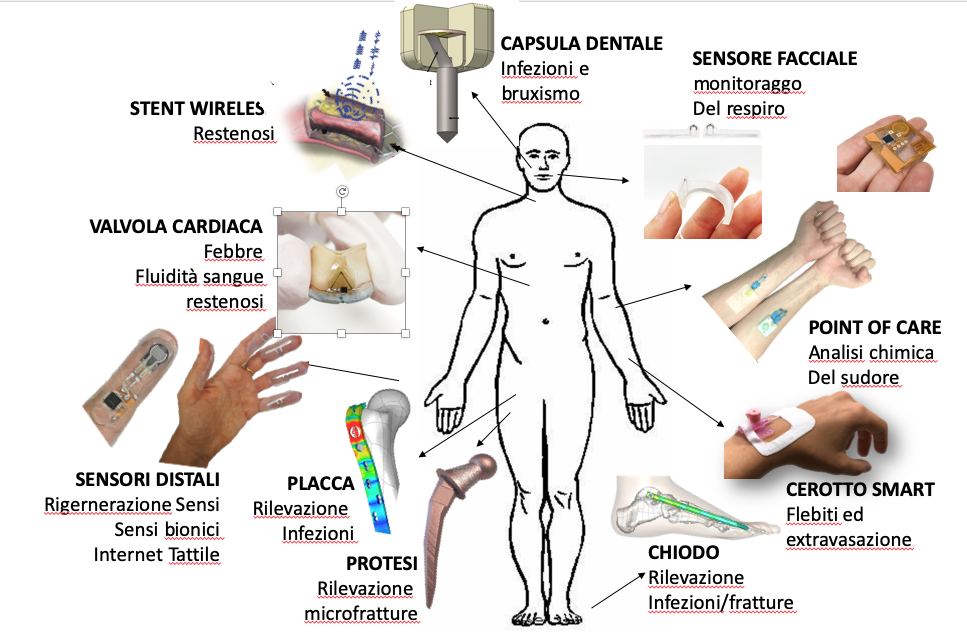 gallery Tecnologia Rfid: sensori nel corpo umano per un monitoraggio cyber